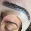 Servicio: Eliminación de Micropigmentación - Imagen 2